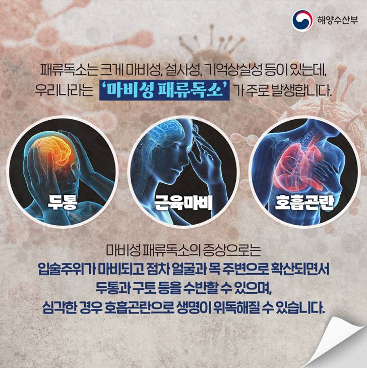 해양수산부 패류독소는 크게 마비성, 설사성, 기억상실성 등이 있는데, 우리나라는 마비성 패류독소가 주로 발생합니다. 두통 근육마비 호흡곤란 마비성 패류독소의 증상으로는 입술주위가 마비되고 점차 얼굴과 목 주변으로 확산되면서 두통과 구토 등을 수반할 수 있으며, 심각한 경우 호흡곤란으로 생명이 위독해질 수 있습니다.